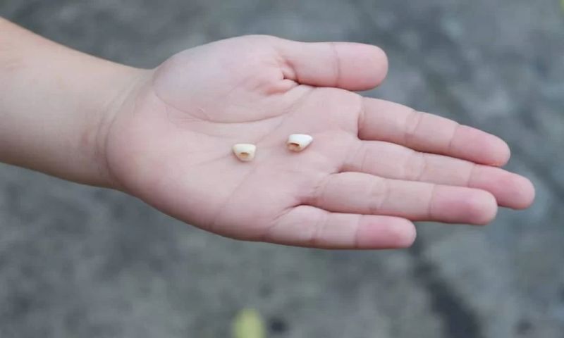 Giải mã chiêm bao thấy răng rụng